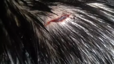 Hirieron a un niño de 6 años en un bar para sacarle el celular