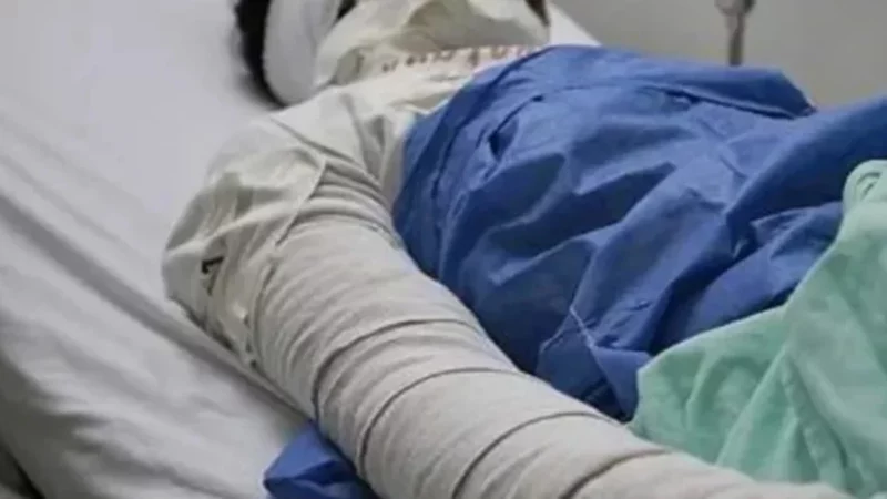 Internaron a una mujer con 80% del cuerpo quemado en un intento de femicidio